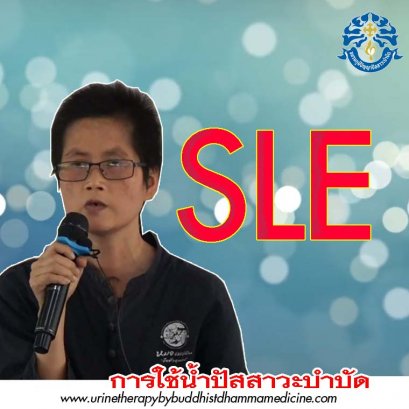 S L E รักษาด้วย ยา 9 เม็ด