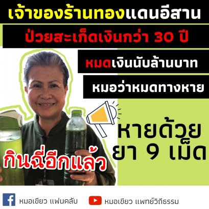 สะเก็ดเงิน 30 ปี หายด้วย ยา 9 เม็ด
