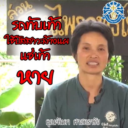 รักษาแผลหายไว้ที่สุด ใช้น้ำปัสสาวะเป็นยารักษาแผล แช่แผลและฉีดสเปรย์ (คุณจันดา ศาสตราชัย)