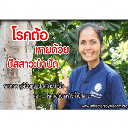 รักษาโรคต้อ  ต้อลม ต้อเนื้อ ต้อกระจก ต้อหิน หายด้วยปัสสาวะบำบัด (คุณธนพร ต้นจาน)