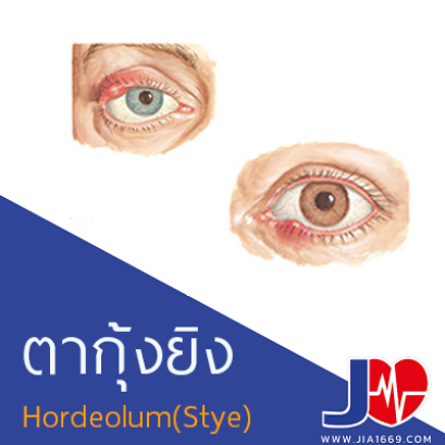 ตากุ้งยิง