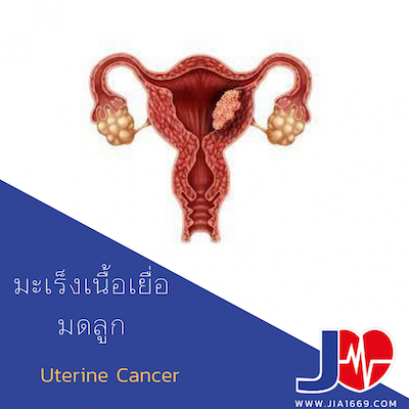 uterine cancer