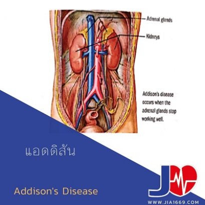 โรคแอดดิสัน