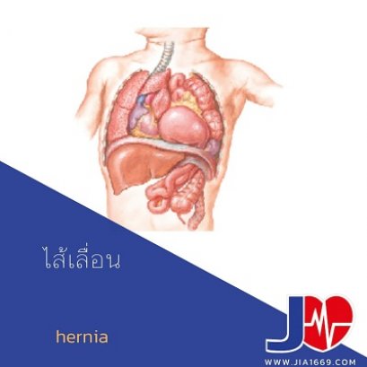 ไส้เลื่อน