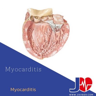 myocarditis กล้ามเนื้อหัวใจขาดเลือด
