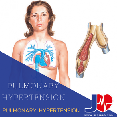 PULMONARY HYPERTENSION