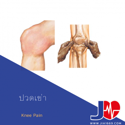 ปวดเข่า