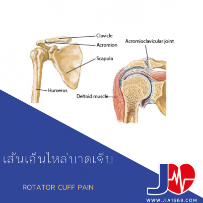 เส้นเอ็นไหล่บาดเจ็บ