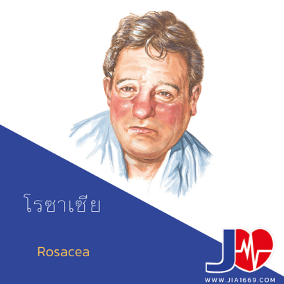 โรซาเซีย 