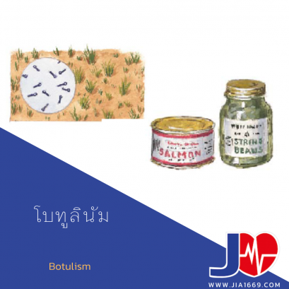 Botulism 