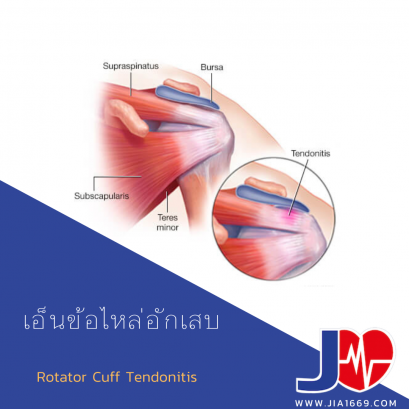 เอ็นข้อไหล่อักเสบ
