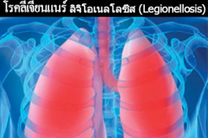 โรคลีเจียนแนร์ ลิจิโอเนลโลซีส (Legionellosis)