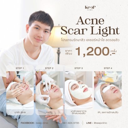 Acne Scar Light