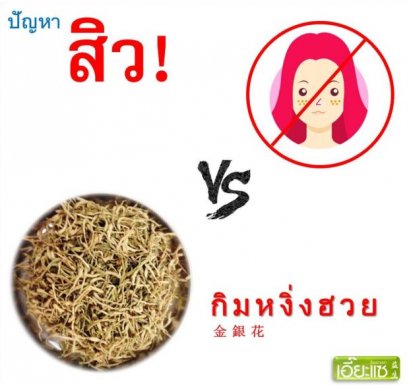 สิว vs กิมหงิ่งฮวย