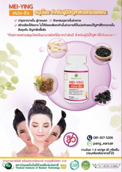  จัดการสิว...ด้วยสมุนไพร