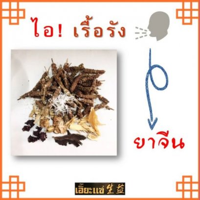 ไอ! เรื้อรัง