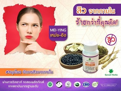 สิวจากภายใน ร้ายกว่าที่คุณคิด?