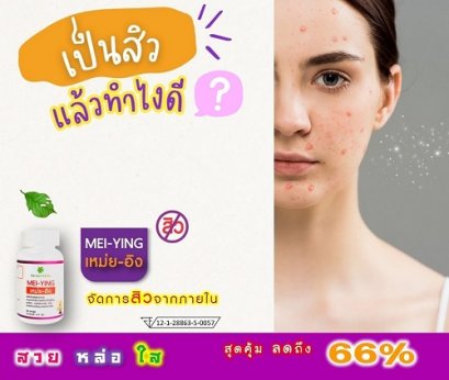 เป็นสิว แล้วทำยังไง