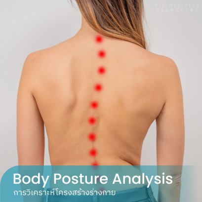 Posture Analysis