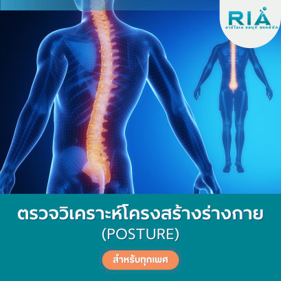 วิเคราะห์โครงสร้างร่างกาย (Posture)