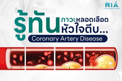 รู้ทันก่อนสาย หลอดเลือดหัวใจตีบ ไม่ได้เกิดขึ้นในวันเดียว ฟื้นฟูหลอดเลือดหัวใจ ตั้งแต่ยังไม่แสดงอาการ ด้วย EECP Therapy