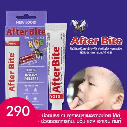 ครีมทาหลังยุงกัด After Bite 