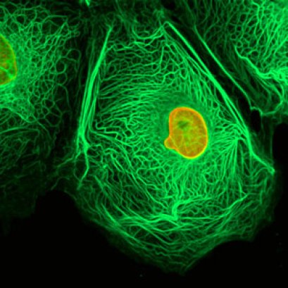 มะเร็งกับการถอดรื้อ มายาคติแห่งการใช้ชีวิต (19/4/2554)