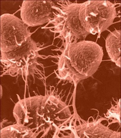 แนวทางการเสริมสร้างระบบภูมิชีวิตอย่างบูรณาการ เพื่อป้องกันโรคมะเร็ง โรคหัวใจ และโรคร้ายแรงอื่นๆ (27) (6/12/2554)