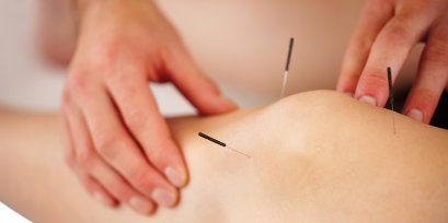 "การฝังเข็ม” ทางเลือกในการรักษา โรคข้อเสื่อม