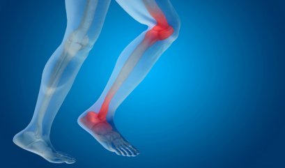 กลูโคซามีน คืออะไร และมีประโยชน์ต่อร่างกายอย่างไร