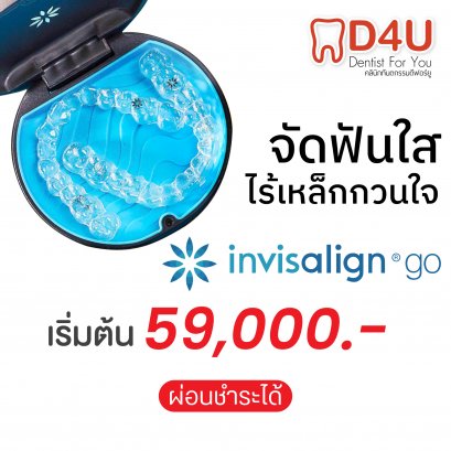 จัดฟันแบบใส invisalign