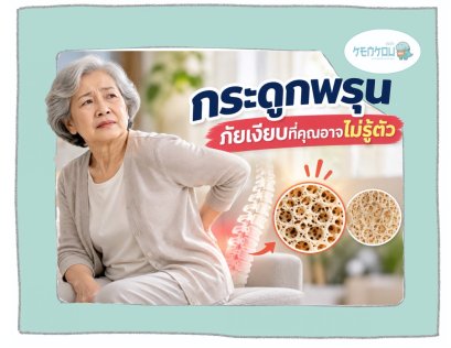 กระดูกพรุน ภัยเงียบที่ไม่มีอาการเตือน จนกระทั่งวันที่มันหัก