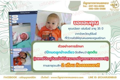 คุณณัชชา เช่นรัมย์ อายุ 35 ปี จากจังหวัดบุรีรัมย์ ที่ไว้วางใจให้คุณหมอหยงดูแลรักษา