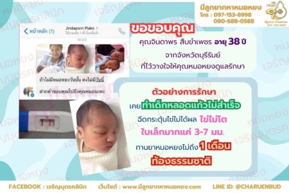 คุณจินดาพร สืบขำเพชร อายุ 38 ปี จากจังหวัดบุรีรัมย์ ที่ไว้วางใจให้คุณหมอหยงดูแลรักษา