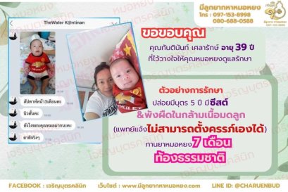 คุณกันตินันท์ เศลารักษ์ อายุ 39 ปี จากจังหวัดกรุงเทพฯ ที่ไว้วางใจให้คุณหมอหยงดูแลรักษา