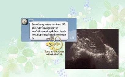 คุณธิดารัตน์ ธนะสิทธิ์ อายุ31ปี จากลพบุรี ปัจจุบันตั้งครรภ์ ได้ 6เดือนแล้ว