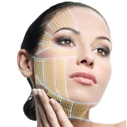 กระชับหน้าตึง ดึงหน้าเรียวด้วย HIFU 