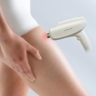 กำจัดขนอย่างเห็นผลกับ Diode 808 nm