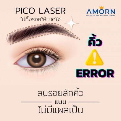 PICO LASER