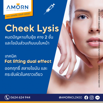 FAT BOM ไขมันส่วนเกินบนใบหน้า