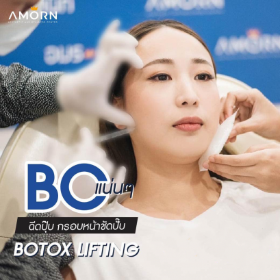 Botox Lifting