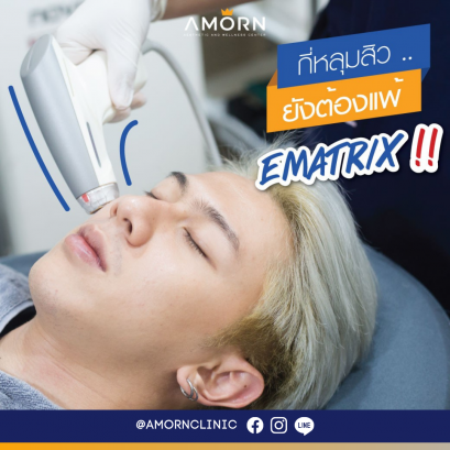 eMatrixTWO หลุมสิว รูขุมขน