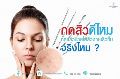 กดสิวดีไหม กดแล้วช่วยให้สิวหายเร็วขึ้นจริงไหม ?