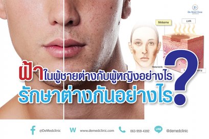 ฝ้าในผู้ชายต่างกับผู้หญิงอย่างไร? รักษาต่างกันอย่างไร?