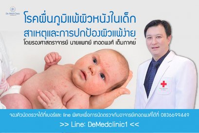 โรคผื่นภูมิแพ้ผิวหนังในเด็ก – สาเหตุและการปกป้องผิวแพ้ง่าย โดยรองศาสตราจารย์ นายแพทย์ เทอดพงศ์ เต็มภาคย์
