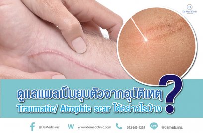 ดูแลแผลเป็นยุบตัวจากอุบัติเหตุ Traumatic/ Atrophic scar ได้อย่างไรบ้าง?