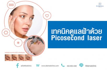 เทคนิคดูแลฝ้าด้วย Picosecond laser