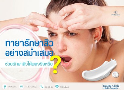 ทายารักษาสิวอย่างสม่ำเสมอช่วยรักษาสิวได้ผลจริงหรือ?