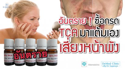 อันตราย ! ซื้อกรด TCA มาแต้มเอง เสี่ยงหน้าพัง