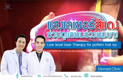 แสงเลเซอร์สีแดงช่วยดูแลผมร่วงผมบาง Low level laser Therapy for pattern hair loss